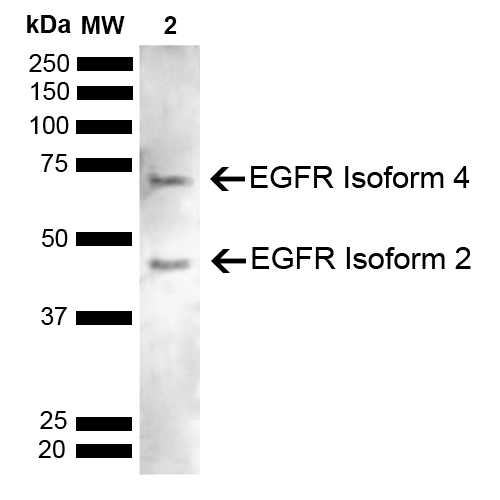  - EGFR Antibody ASM10620